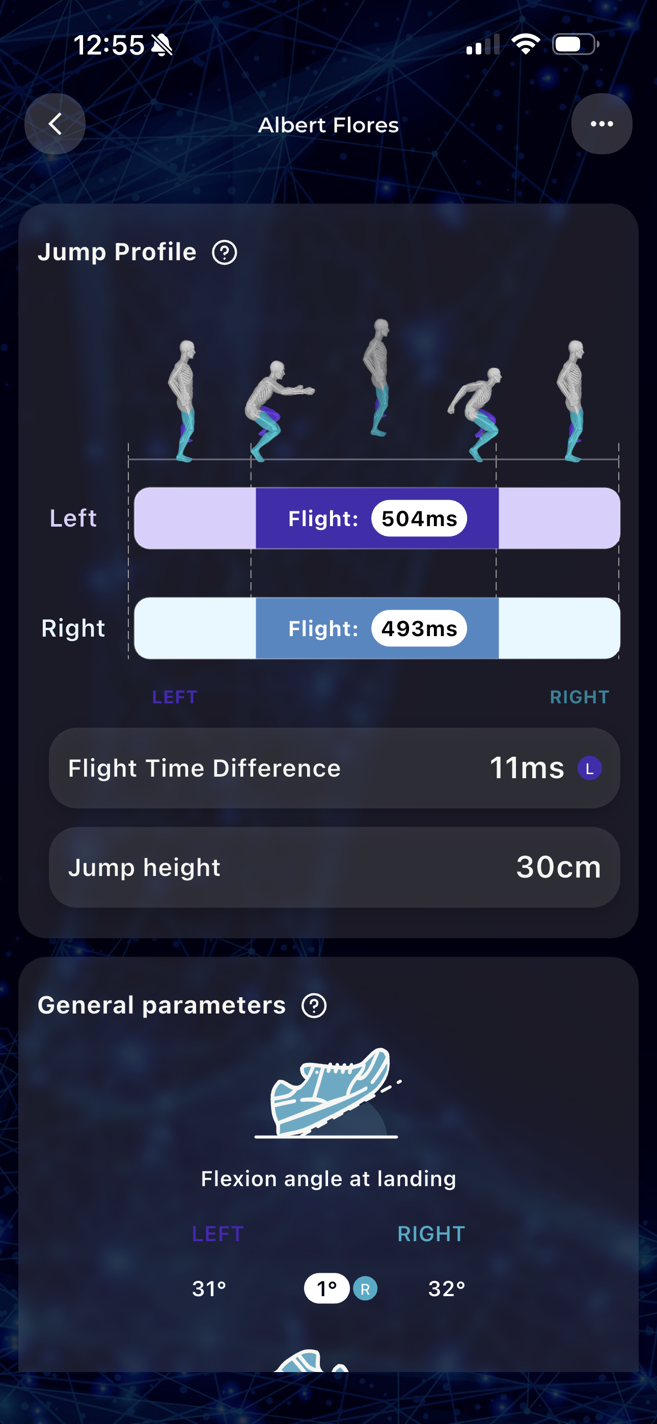 Counter Movement Jump
